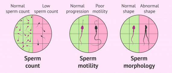 to when sperm check count